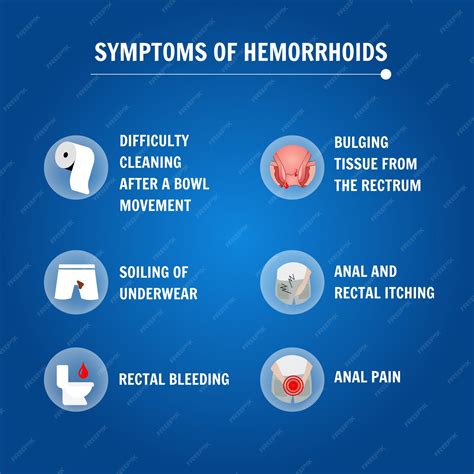 On Hemorrhoids Reader