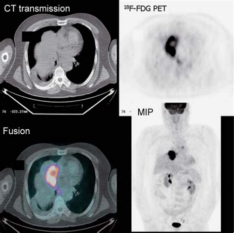 Oncologic Imaging Epub