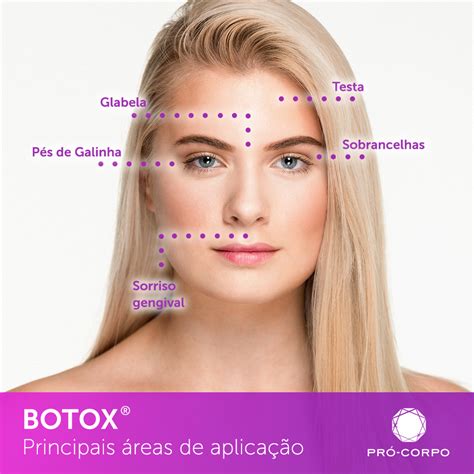 Onde Aplicar o Botox no Rosto: Um Guia Completo