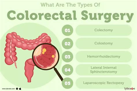 Operative Colorectal Surgery Epub