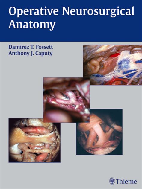 Operative Neurosurgical Anatomy 1st Edition Doc