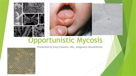 Opportunistic Mycosis Practical Manual for Diagnosis and Infections Epub