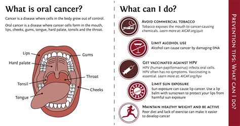 Oral Cancer Lump on Gum: A Comprehensive Guide to Diagnosis, Treatment, and Prevention