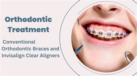 Orthodontic AssistantPassbooks Doc