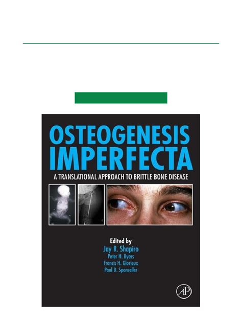 Osteogenesis Imperfecta A Translational Approach to Brittle Bone Disease 1st Edition Doc