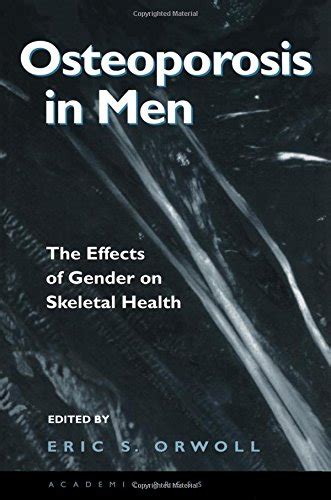 Osteoporosis in Men The Effects of Gender on Skeletal Health Kindle Editon