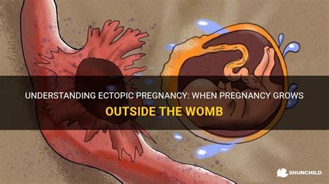 Outside the Womb Kindle Editon