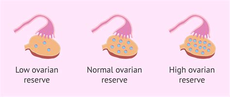 Ovarian Reserve: