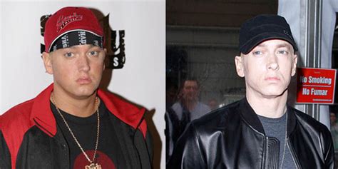 Overweight Eminem: A Wake-Up Call for America's Obesity Epidemic