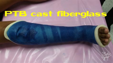 PTB cast