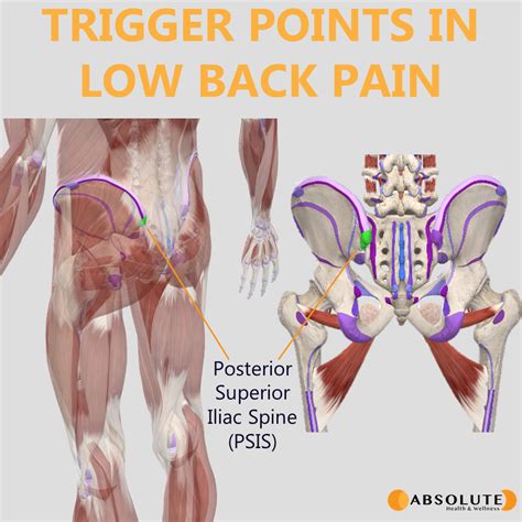 Pain Points of Lower Lows