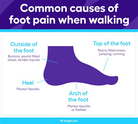 Pain in Sole of Foot When Walking: A Comprehensive Guide to Causes, Treatment, and Prevention