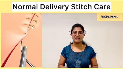 Pain in Stitches After Normal Delivery: 10,000+ Essential Tips