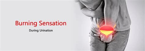 Pain or burning during urination