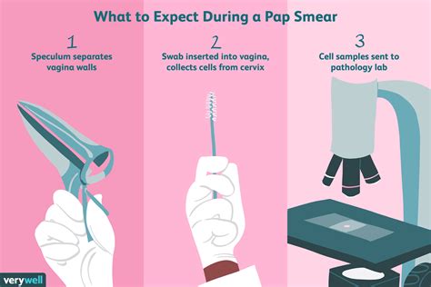 Pap smear: