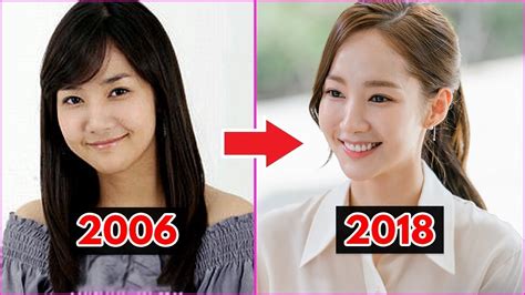 Park Min Young Before Plastic Surgery: A Visual Transformation