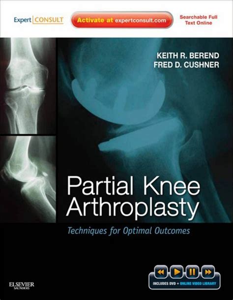 Partial Knee Arthroplasty Techniques and Optimal Outcomes Kindle Editon