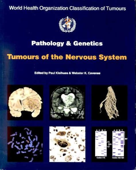 Pathology of Tumors of the Nervous System Doc