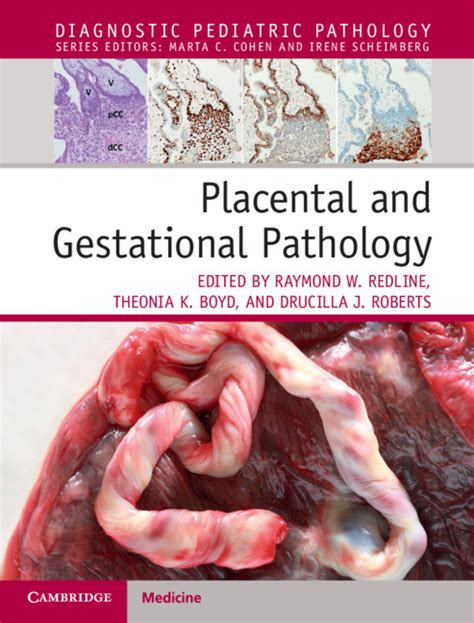 Pathology of the Placenta PDF
