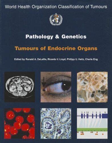 Pathology.and.Genetics.of.Tumours.of.Endocrine.Organs Ebook Kindle Editon