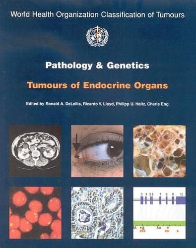 Pathology.and.Genetics.of.Tumours.of.Endocrine.Organs Ebook Kindle Editon