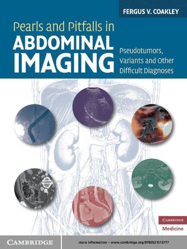 Pearls.and.Pitfalls.in.Abdominal.Imaging.Pseudotumors.Variants.and.Other.Difficult.Diagnoses Ebook Epub