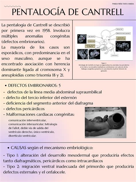 Pentalogia Doc