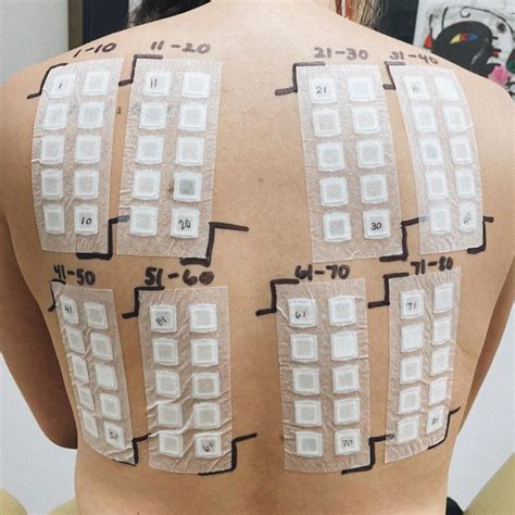 Perform a Patch Test: