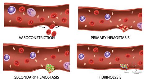 Perinatal Thrombosis and Hemastasis Epub