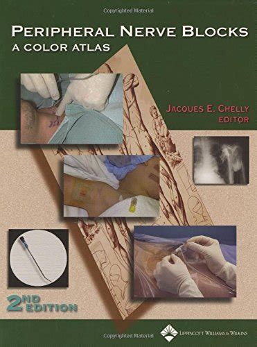 Peripheral Nerve Blocks A Color Atlas PDF