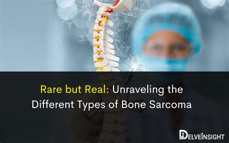 Pick a Bone: The Comprehensive Guide to Bone-Based Innovations