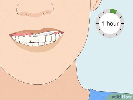 Place the pouch between your lip and gum: