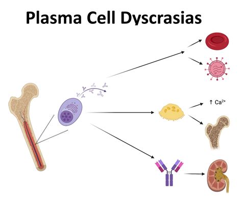 Plasma: