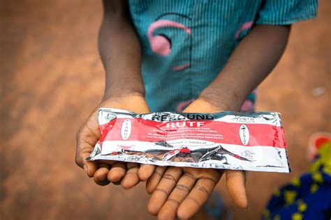 Plumpy'mage: A Revolutionary Treatment for Severe Acute Malnutrition