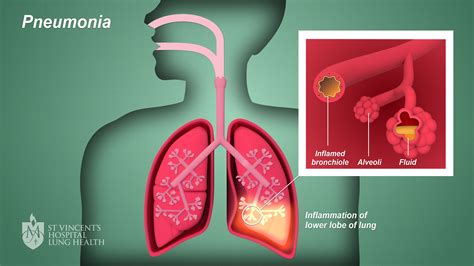 Pneutomanie Doc