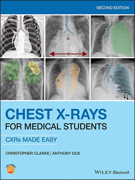 Pocket Guide to Chest X-rays 2nd Edition PDF