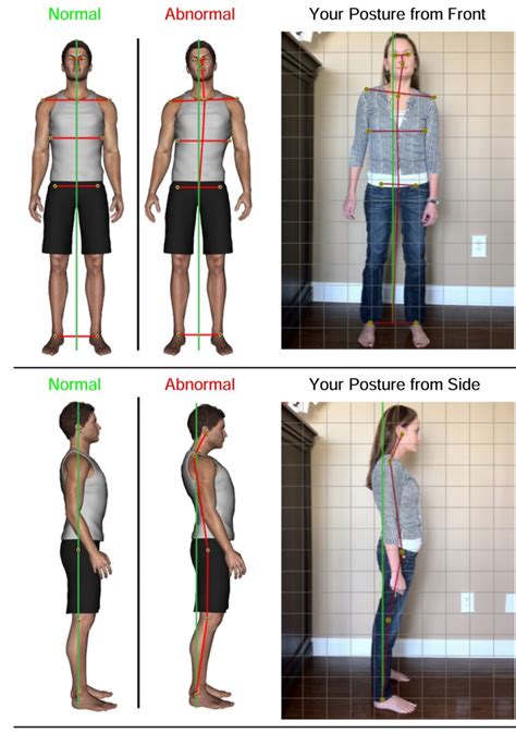 Postural Correction Epub