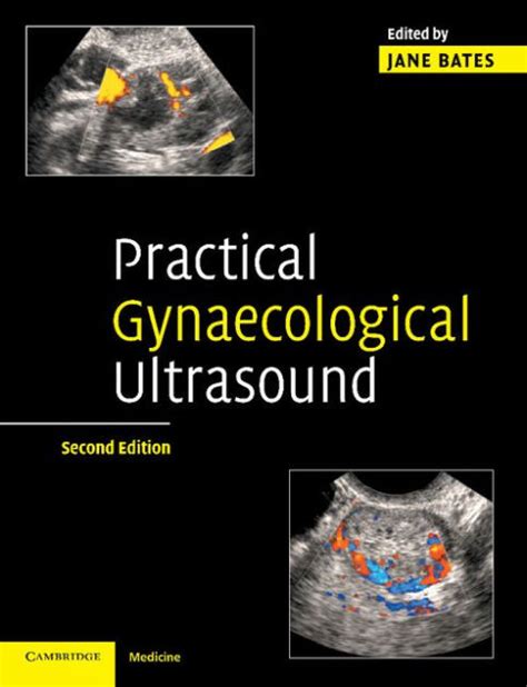 Practical Gynaecological Ultrasound Reader