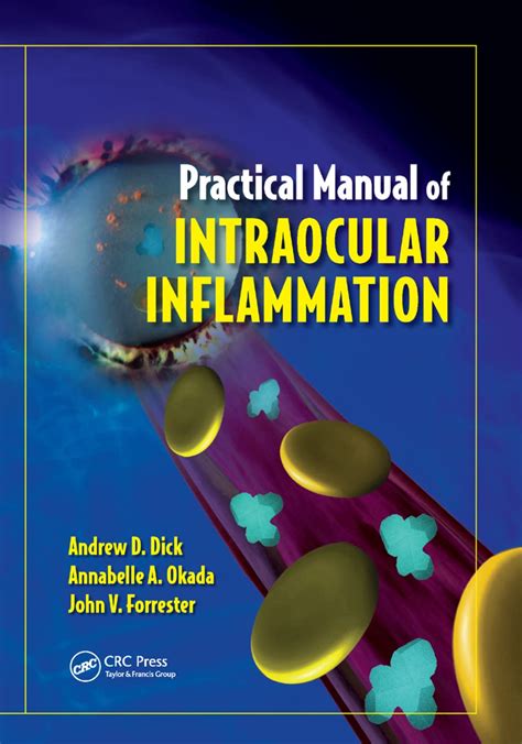 Practical Manual of Intraocular Inflammation Kindle Editon