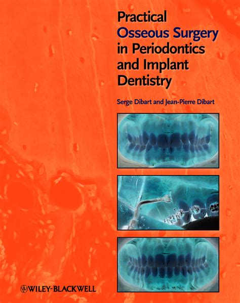 Practical Osseous Surgery in Periodontics and Implant Dentistry PDF