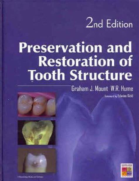 Preservation and Restoration on Tooth Structure by Graham J Mount 5 Star Review pdf Doc