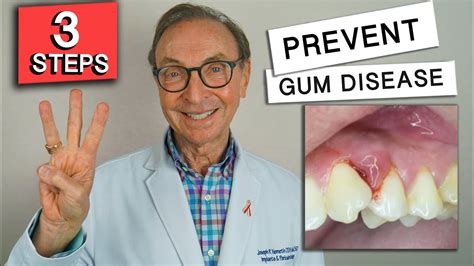 Prevents Gum Disease: