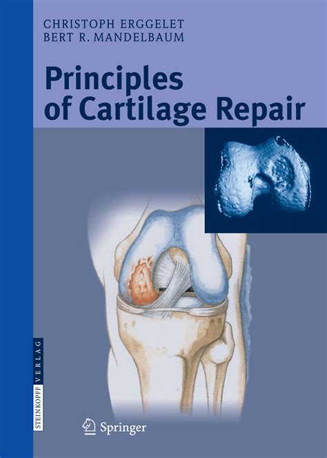 Principles of Cartilage Repair Doc