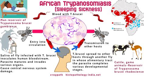 Progress in Human African Trypanosomiasis, Sleeping Sickness PDF