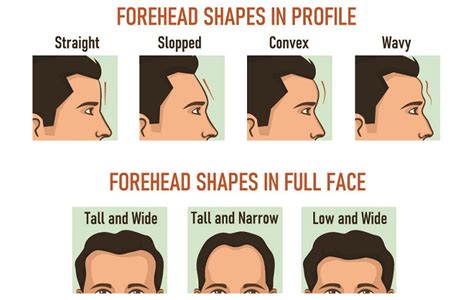 Prominent forehead: