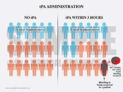 Pros of Using a TPA