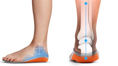 Protalus Arch Support: Redefining Foot Health and Comfort