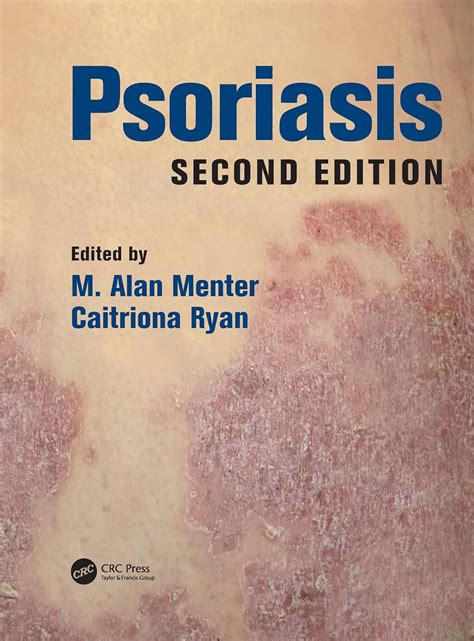 Psoriasis Ebook Doc