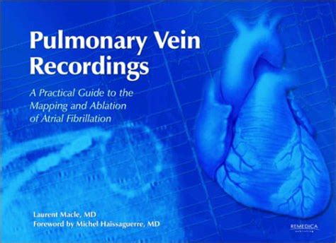 Pulmonary Vein Recordings A Practical Guide to the Mapping and Ablation of Atrial Fibrillation 2nd E Kindle Editon