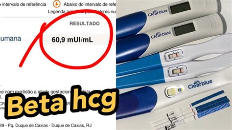 Quanto Custa um Beta HCG? Guia Completo com Informações Atualizadas